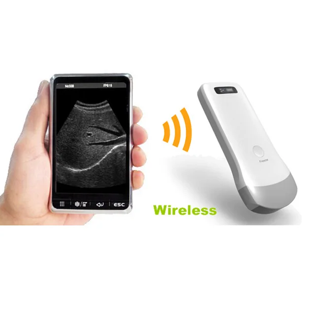 Mini wireless ultrasound machine probe Wifi ultrasound probe