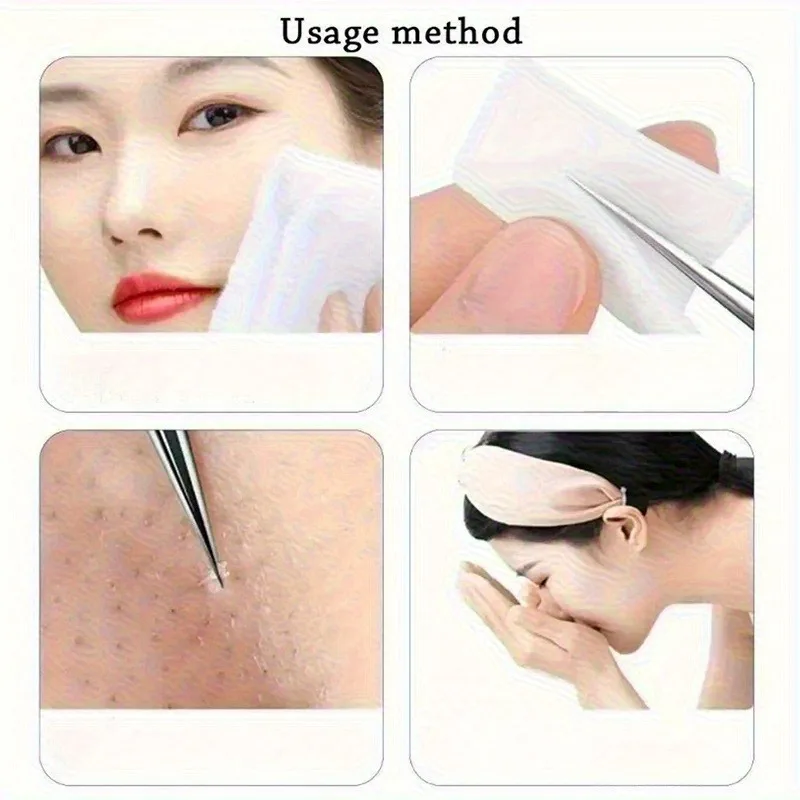 Mee-eter Clip Puistjes Pincet Mee-eter Remover Roestvrijstalen Mobiele Clip Schoonheidsproduct Acne Naald Huidreinigingsgereedschap
