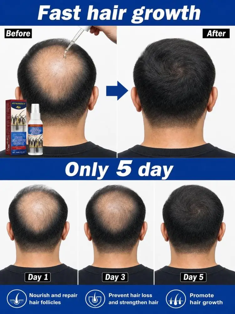

Nourishes and strengthens hair, turning thinning hair into thicker hair. Prevents hair loss at its source.