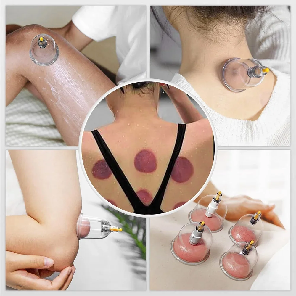 22 กระป๋องสําหรับนวดสูญญากาศ Cupping ชุดจีนกายภาพบําบัดเซลลูไลท์ถ้วย Cupping Therapy Heathly Care