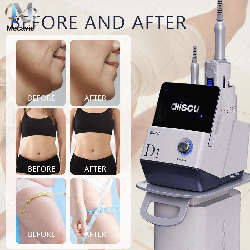 MECAVIE 2025 New Professional D1 internal fat knife fascia knife instrument firming body slimming weight loss Meridian Dredging