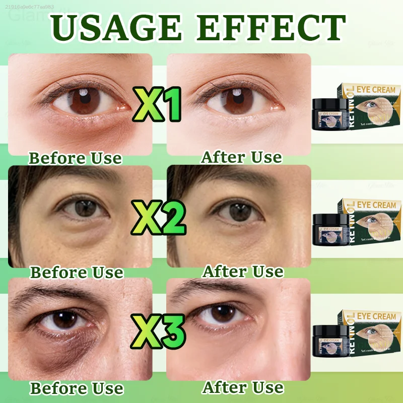 Retinol Eye Cream for Daily Eye Skin Care, Deeply Hydrate and Nourish Skin Around Eyes, Improve the Look of Fine Lines, Smooth Eye Texture, Boost Firm Feeling of Eye Area Skin for Men and Women