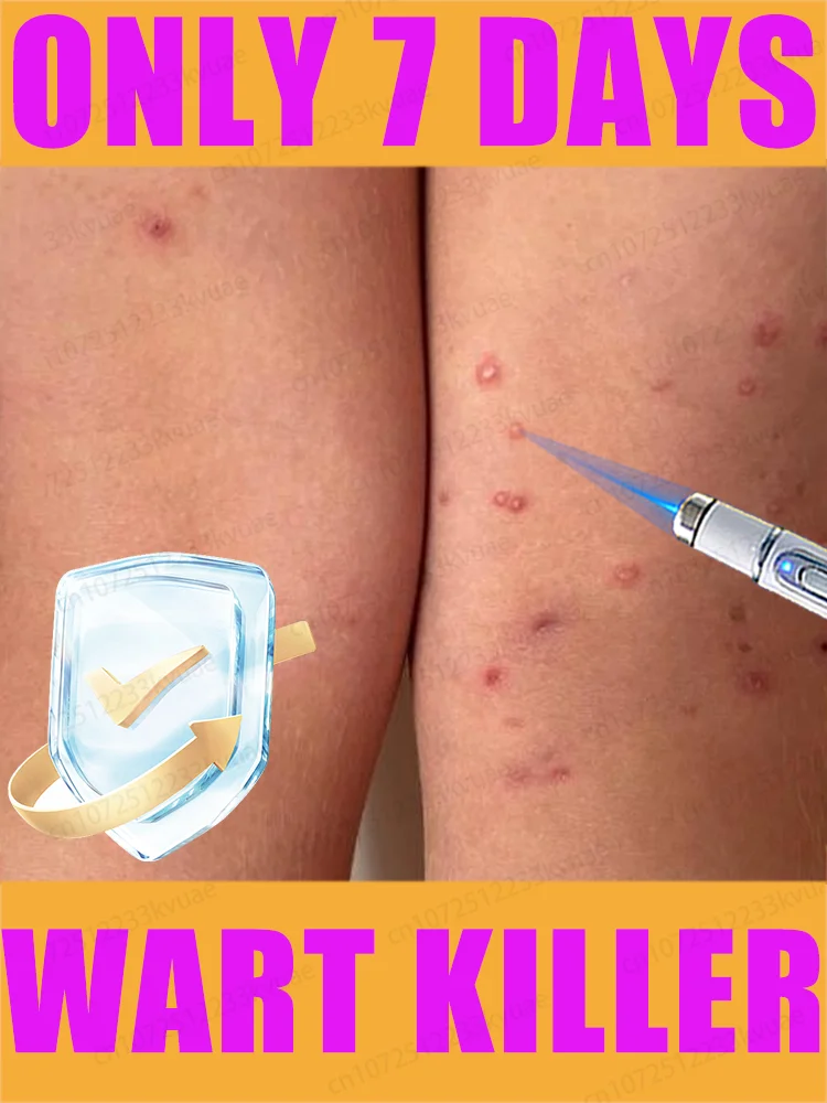 

1st ᵍᵉⁿᵉʳᵃᵗⁱᵒⁿ ᵘᵖᵍʳᵃᵈᵉᵈ wᵃʳᵗ ⸴ ʳᵉpᵃⁱʳ wᵃʳᵗˢ ʳᵒoᵗ ⸴ ᑫᵘⁱᶜᵏˡʸ