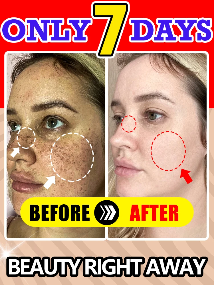 

Essential oils that quickly remove facial spots in a short period of time