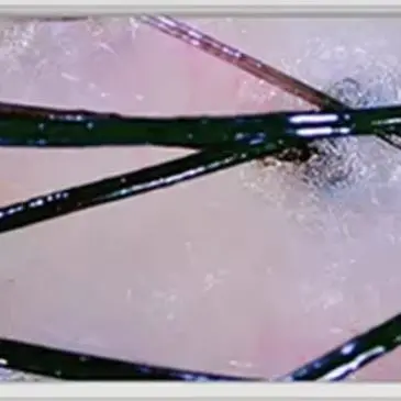 10インチLCD頭皮検出器デジタル毛髪皮膚アナライザー顕微鏡、毛包検査および皮膚分析用拡大鏡50/200倍