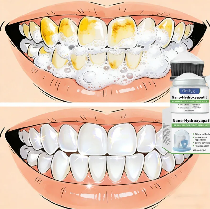 10% Hydroxyapatite …