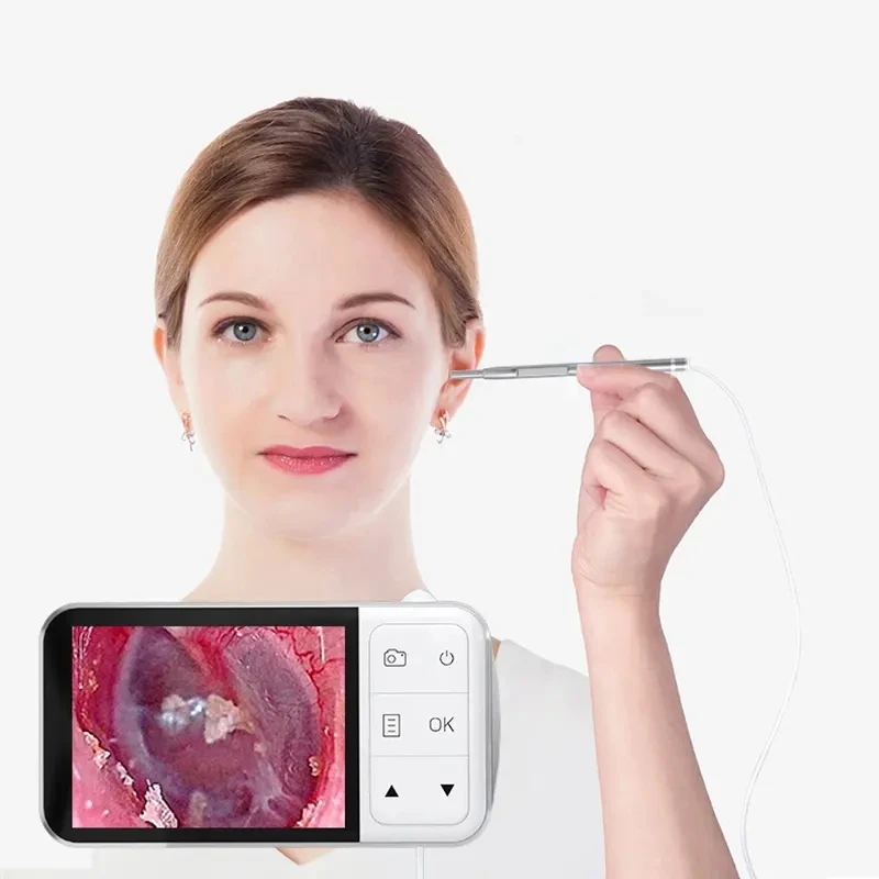 C02 HD1080P Ear Infuse Camera Earscope Endoscope Camera 3.9MM 4.5-inch Screen Digital Earwax Removal Tool