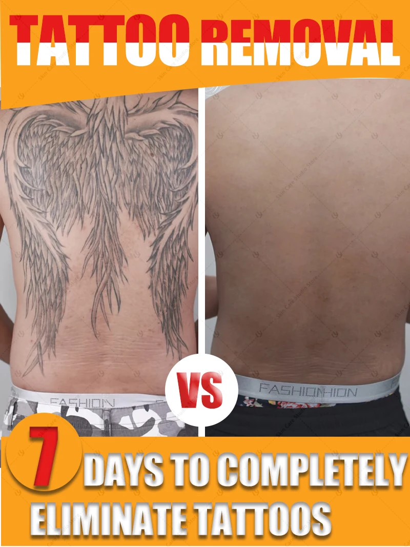 เซรั่มกําจัดแต่งหน้าถาวรเม็ดสีรอยสักด่วน