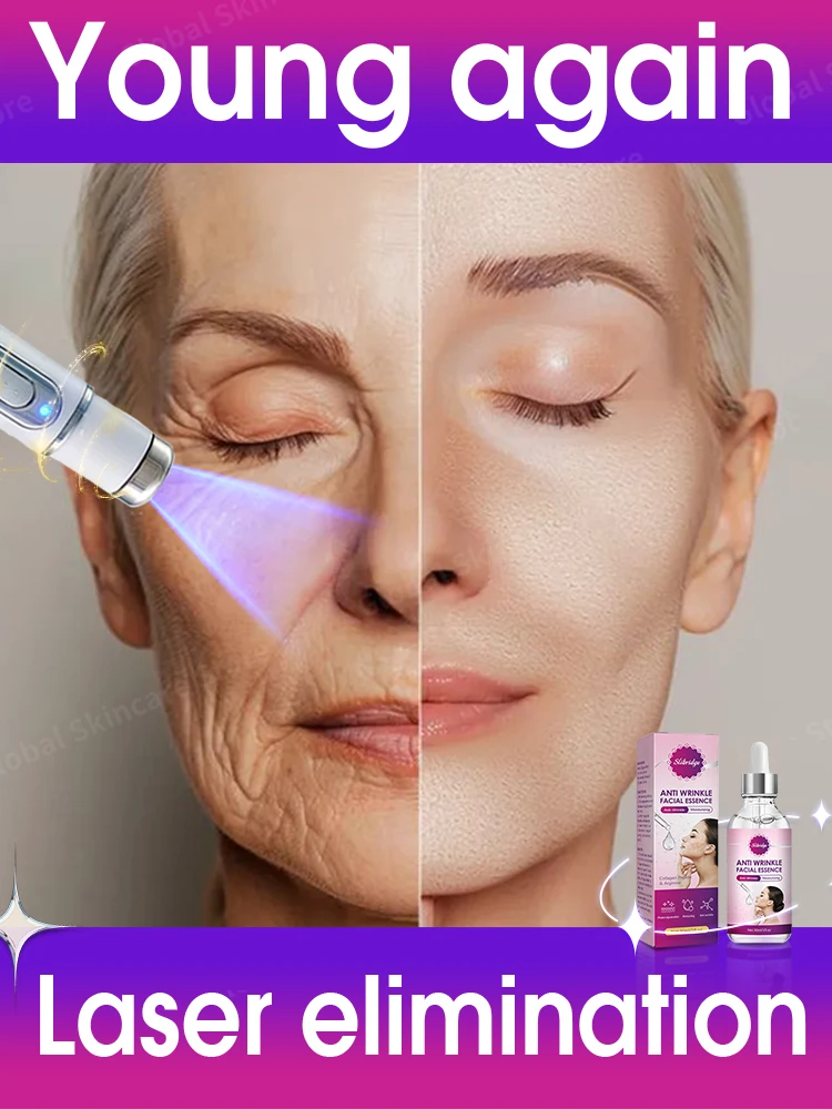 Solve all facial wrinkle problems