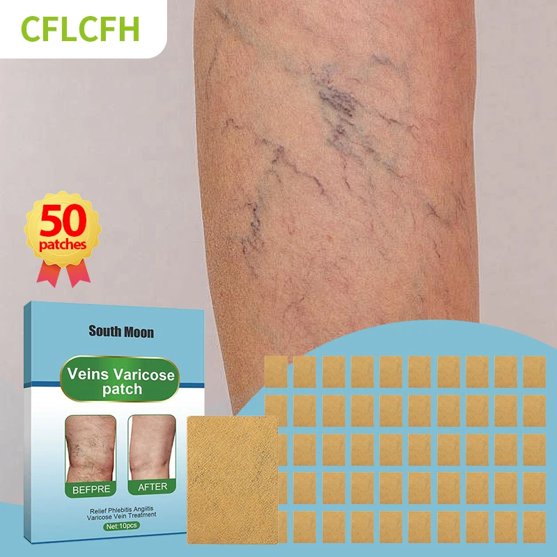 50Pcs Varicose Veins Relief Patch Spider Leg Vasculitis Phlebitis Treatment Varicosity Angiitis Legs Dilated Plaster Foot Care