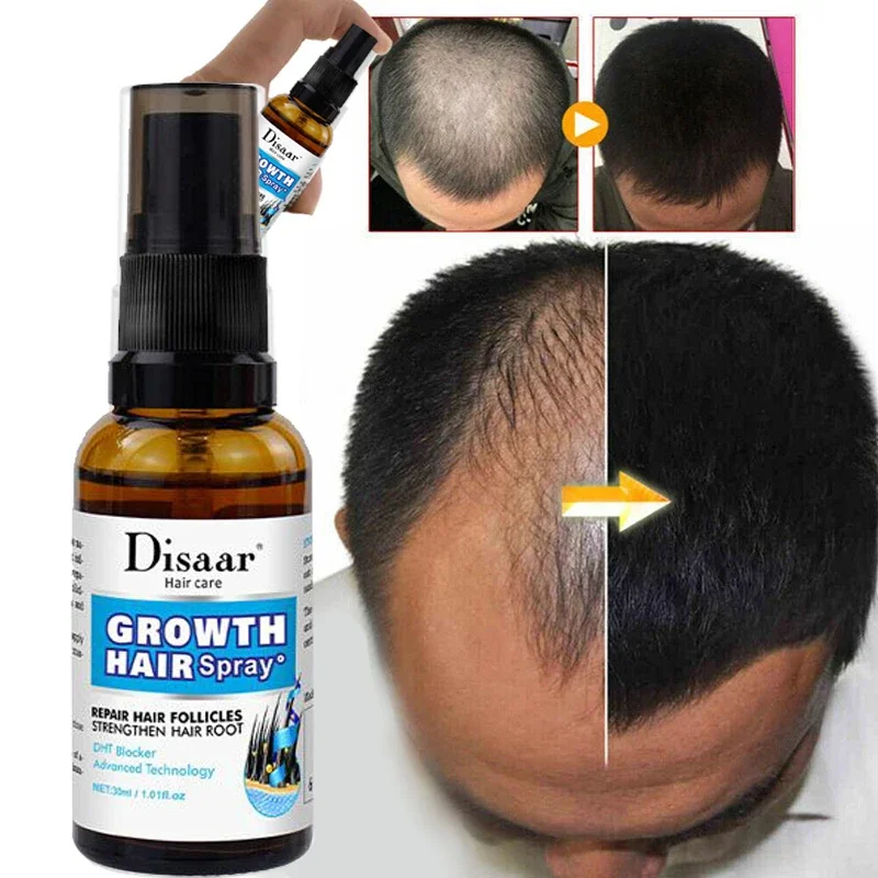 30ml Hair Growth Serum Spray Fast Grow Prevent Hair Loss Dry Frizzy Nourishing Soften Scalp Treatment Health Care for Men Women