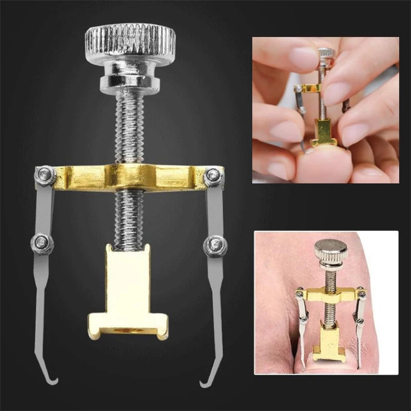 

Корректор для вросших ногтей на ногах, устройство для восстановления и исправления, инструмент для педикюра и ухода за ногтями, выпрямляющий зажим-фиксатор, простой в использовании