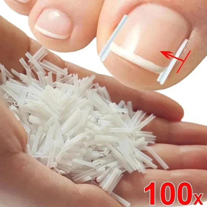 10-40PCS Ingrown Toenail Correction Ultra-Thin Nail Treatment Elastic Patch Sticker Straightening Nails Groove Ingrown Corrector