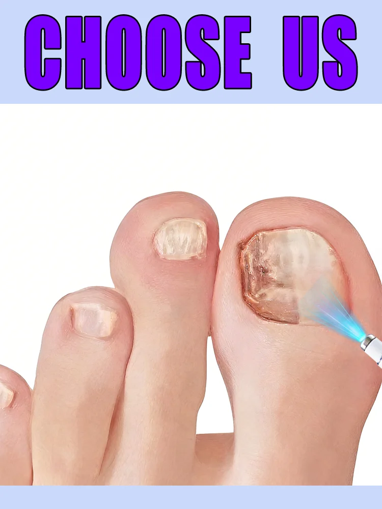 99.99% safe and reliable, your top pick for tidy nail care, suitable for everyone.