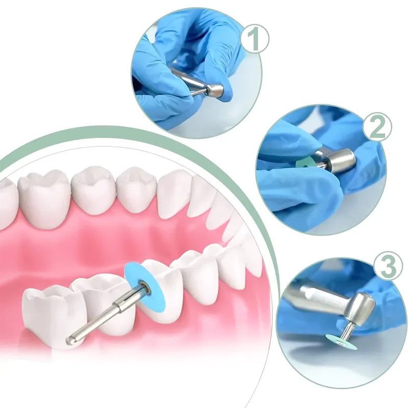 Discos De Polimento Composto Dental, Kit De Polimento Oral, Discos De Moagem De Resina, Clareamento Dental, Materiais Odontologia, 40 Pcs, 80Pcs