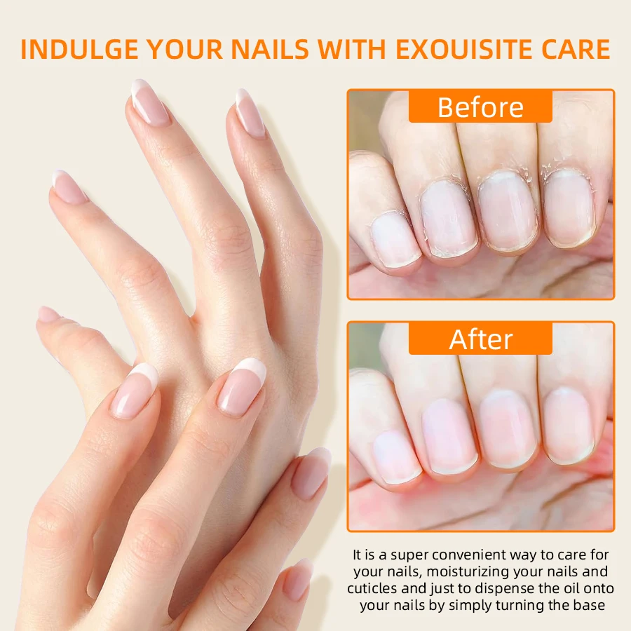 RSNAIL 2 مللي زيت تغذية الأظافر القلم علاج الأظافر القلم 3 رائحة بشرة الأظافر النفط القلم تليين تغذي الجلد مانيكير منتجات العناية بالأظافر