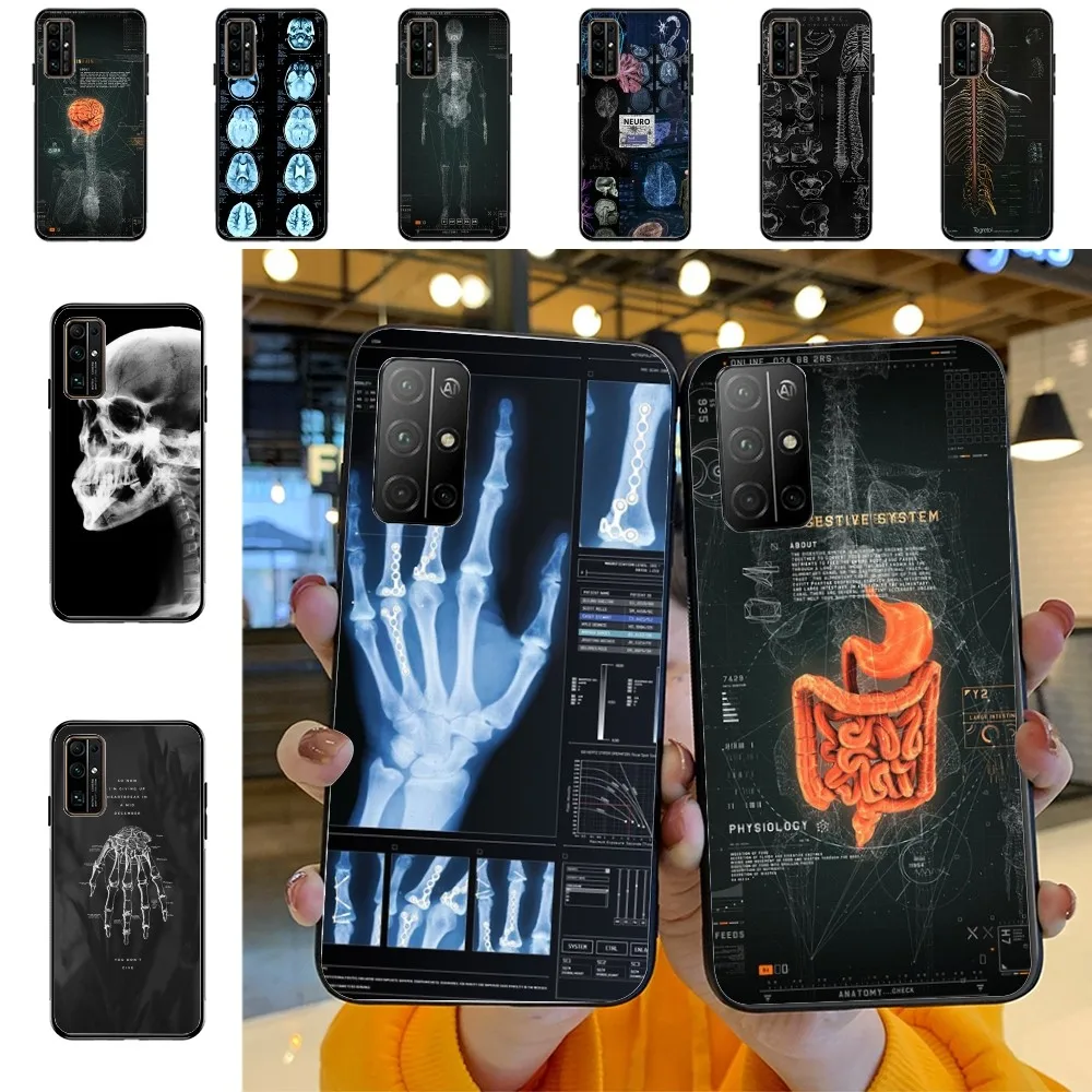 Radiological human organs Skeleton Phone Case For Huawei Honor 10 lite 9 20 7A 9X 30 50 60 70 pro plus Soft Silicone Cover