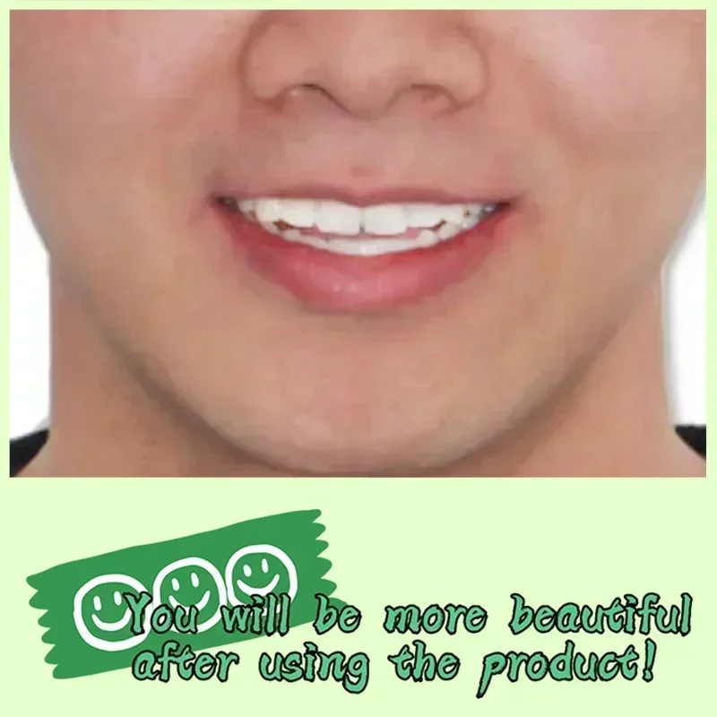 3R إصلاح سريع للتسوس إزالة البقع البلاكية تسوس تبييض اصفرار إصلاح تبييض الأسنان #2