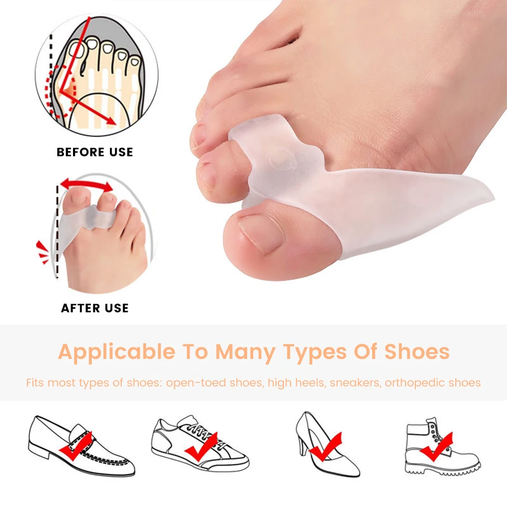 SEBS Hallux Valgus Bunion Corrector Silicone Toe corrector Foot Pain Relief toe splitter Thumb wear-resistant Foot Care tool