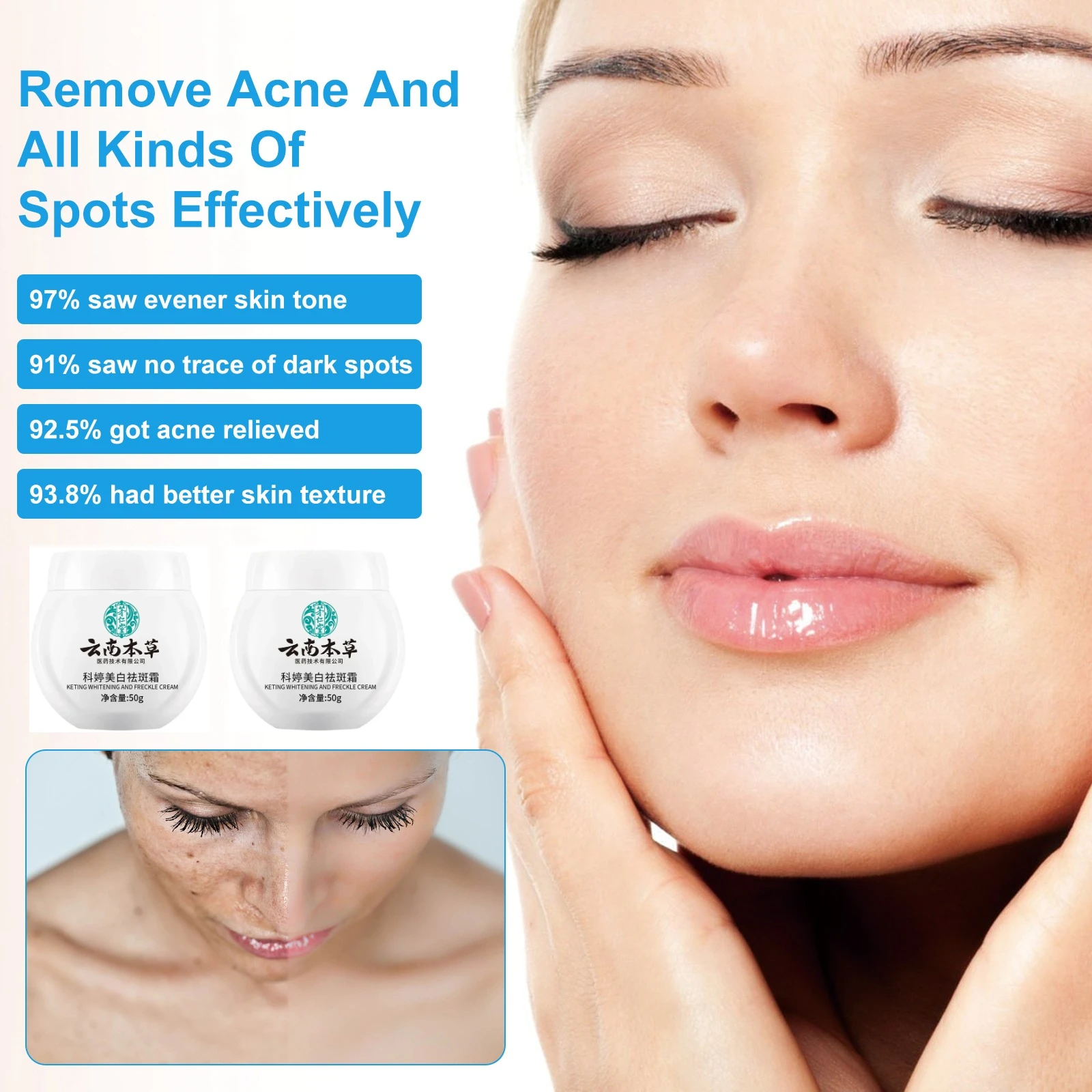 50g/box Whitening and Spot Removing Cream Suitable for Male and Female Body Care