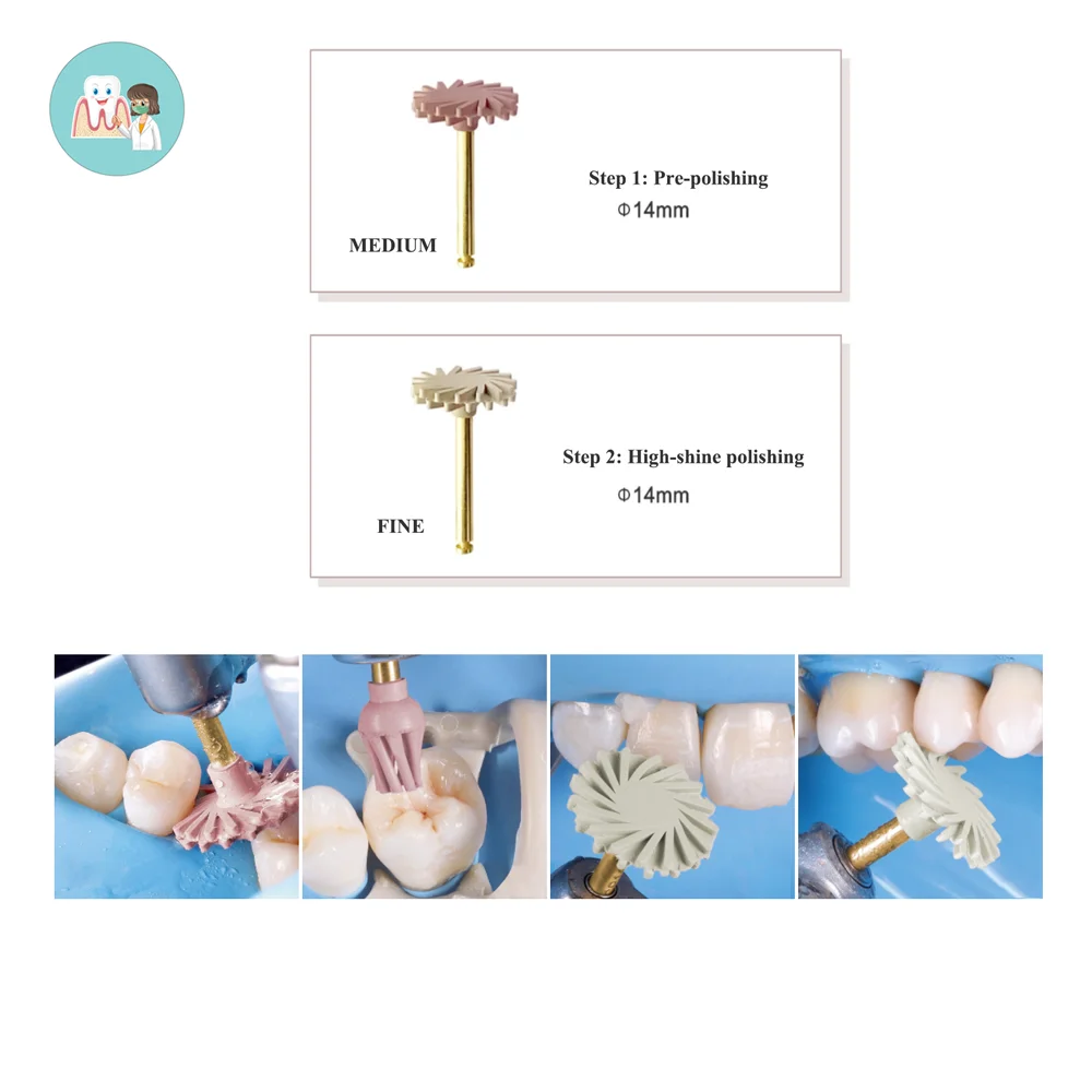 

Полировка композитной стоматологической смолы: двухступенчатая система циклонных колес для оптимальной высокоглянцевой отделки