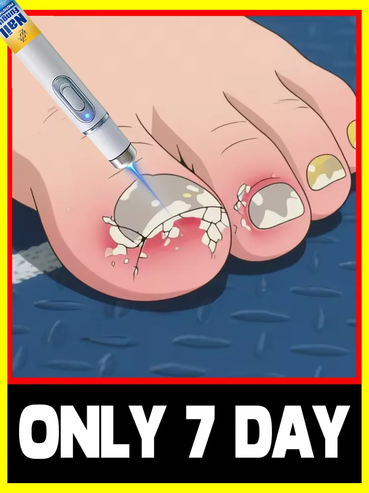 

The fifth generation of champagne-colored nail laser penʜᴇʟᴘs ʏᴏᴜ sᴀʏ ɢᴏᴏᴅʙʏᴇ ᴛᴏ ᴏɴʏᴄʜᴏᴍʏᴄᴏsɪs. Tᴇᴄʜɴᴏʟᴏɢʏ ᴄʜᴀɴɢᴇs ʏᴏᴜʀ ʟɪharᴇ。