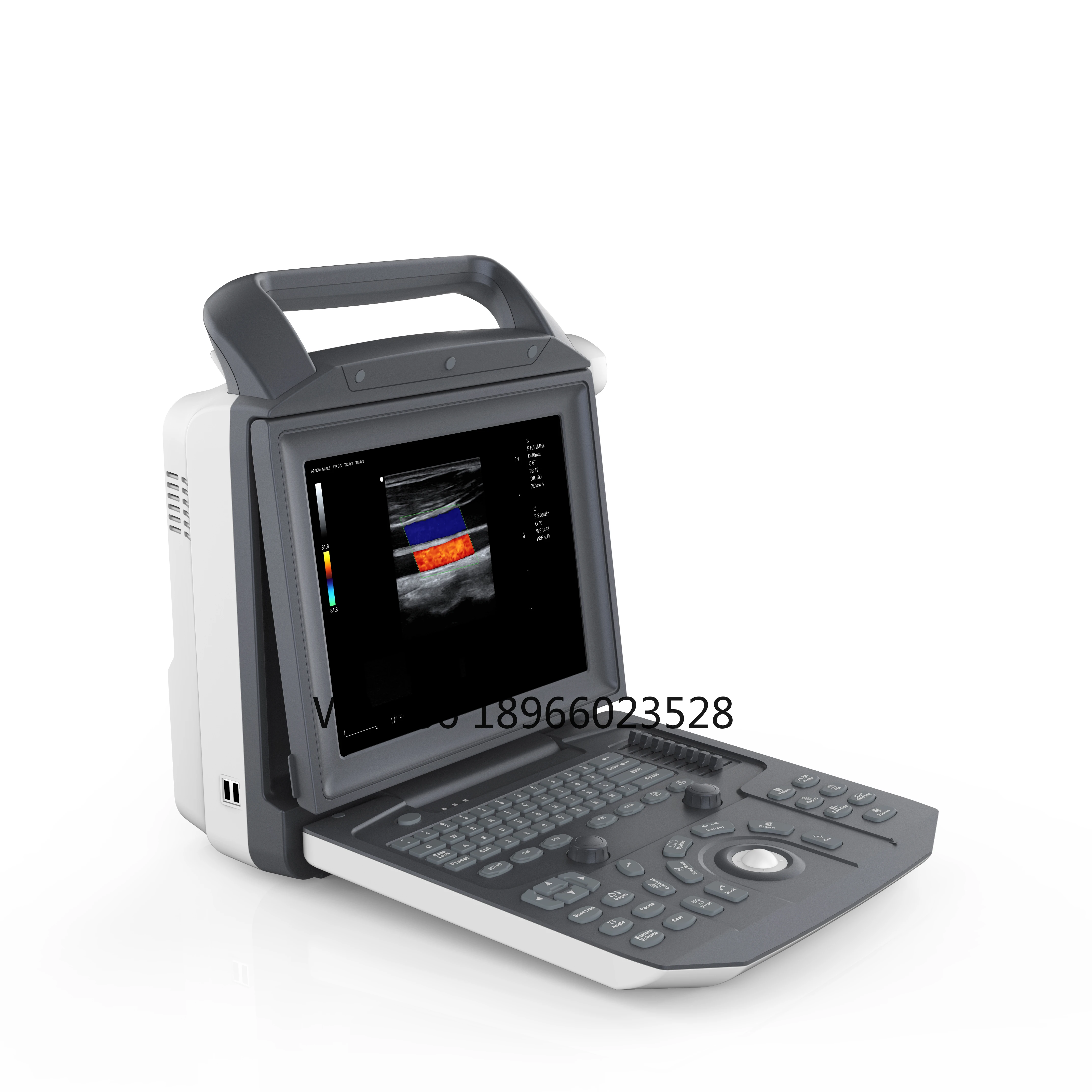 LTUB73 All-Digital Portable  Ultrasound Scanner