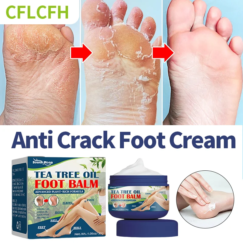 

Anti Crack Foot Cream Moisturizing Emollient Hand Heel Dead Skin Removal Peeling Drying Cracked Feet Repair Ointment Foot Care