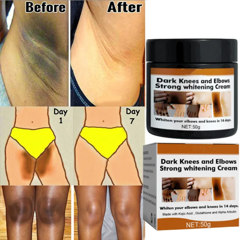 Body Whitening Cream Fast Bleach Private Parts Lighten Underarm Legs Knees Melanin Intimate Areas Remove Dark Spot Beauty Health