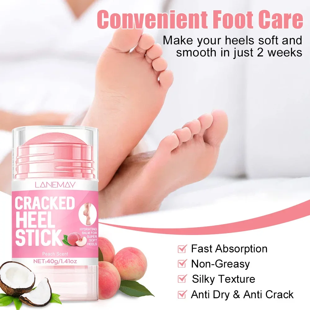 Ultra-Hydrating Foot Care ครีม Anti-Drying Crack Removal Dead Moisturizing Skin Hand Feet Care Softening Calluses Cracked ครีม