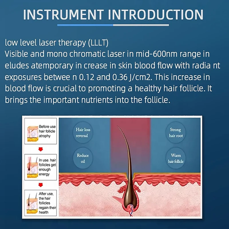 650nm diodo laser lllt terapia tratamento de perda de cabelo 5 em 1 máquina de recrescimento do cabelo couro cabeludo saúde anti-calvo equipamento de salão de beleza