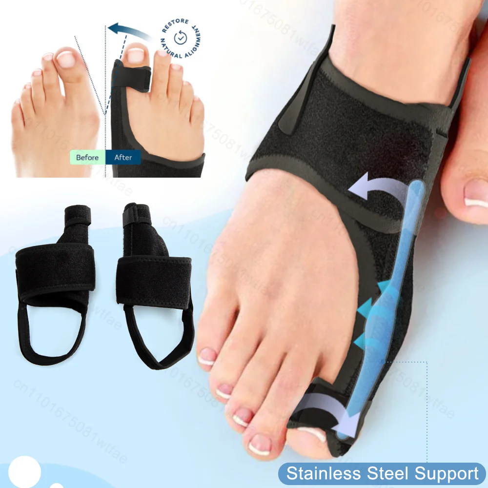 

Toe Correction Hallux Valgus Corrector Straightening Big Toe Orthotics Stainless Steel Support Strap Feet Separator Bunion