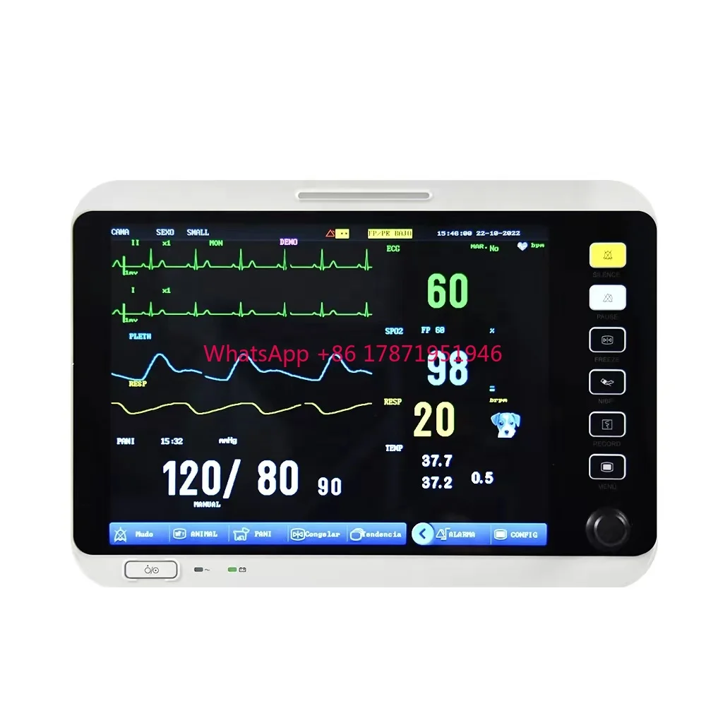 VM12 12 inch Veterinary Patient Monitor Multiparameter Vital Sign Monitor For Animal