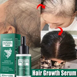 Ginger Hair Growth Product Anti-loss Hair Regrowth Serum Oil Fast Grow Prevent Baldness Treatment Alopecia Men Women Hair Care