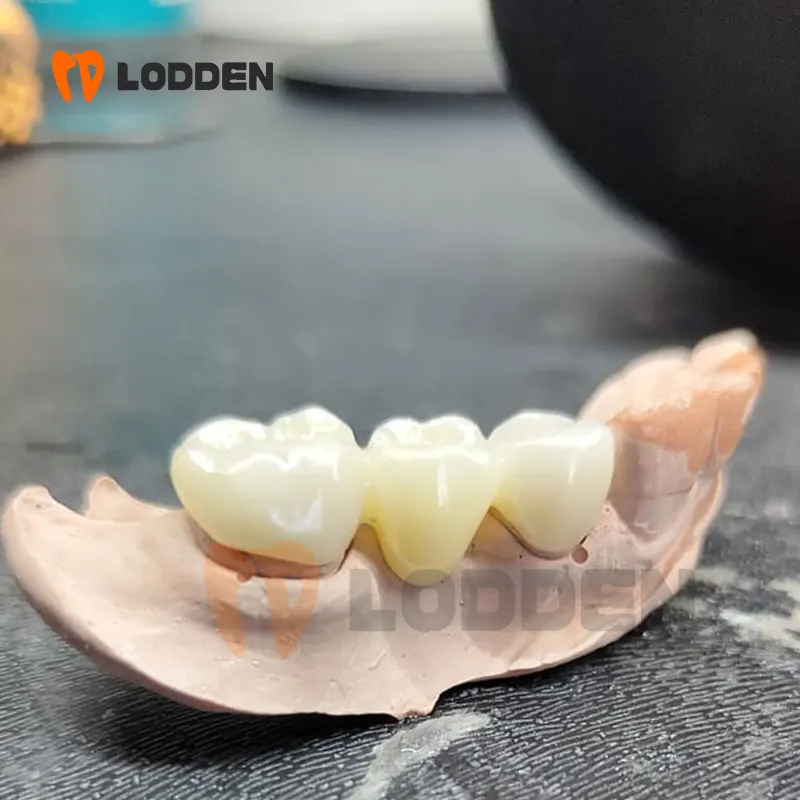 LODDEN Dental Lab 3D Pro Max Zirconia 98*22 มม.5 ชั้นหลายบล็อก Zirconia แผ่นฟันปลอมวัสดุความโปร่งใส 43%-51%