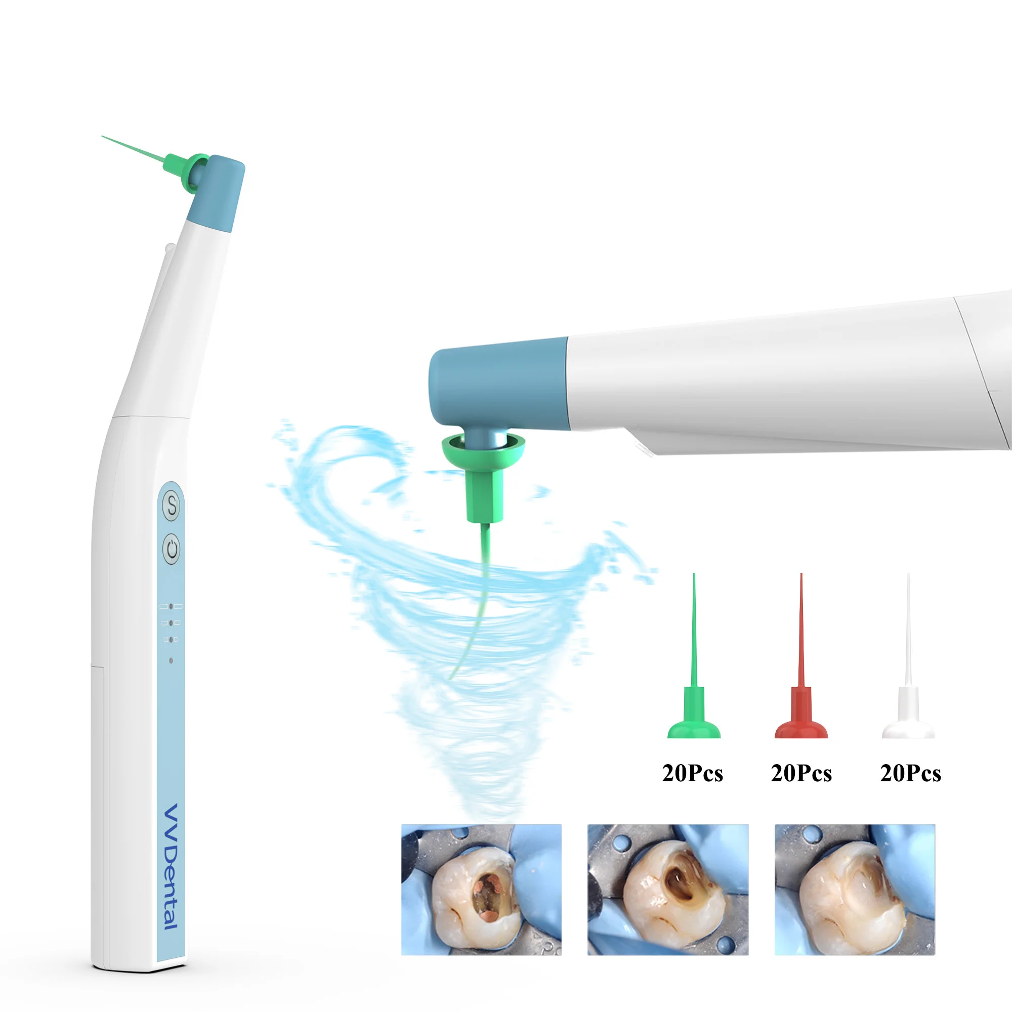 Chân Răng Sonic Irrigator Kích Hoạt Với Bộ 60 Endo Các Tập Tin Cho Endodontic Vệ Sinh Và Tưới Mới Nha Khoa Thiết Bị