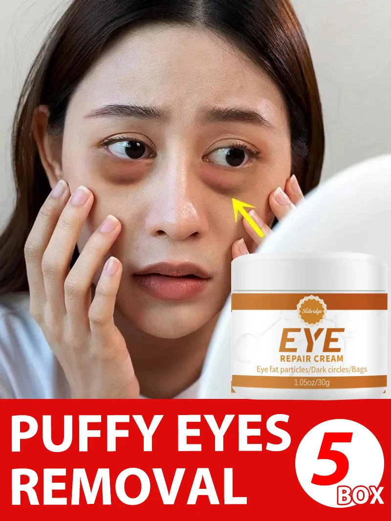 

Solve the eye problems