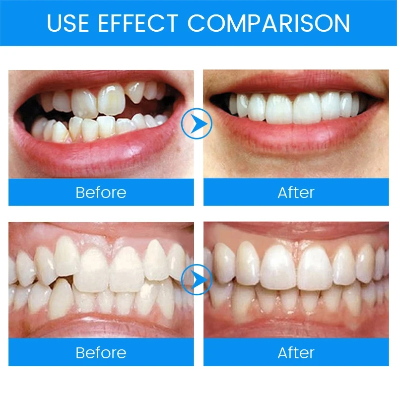 Thumbnail 4 - #2 Trending Dental Mouthguards Right Now