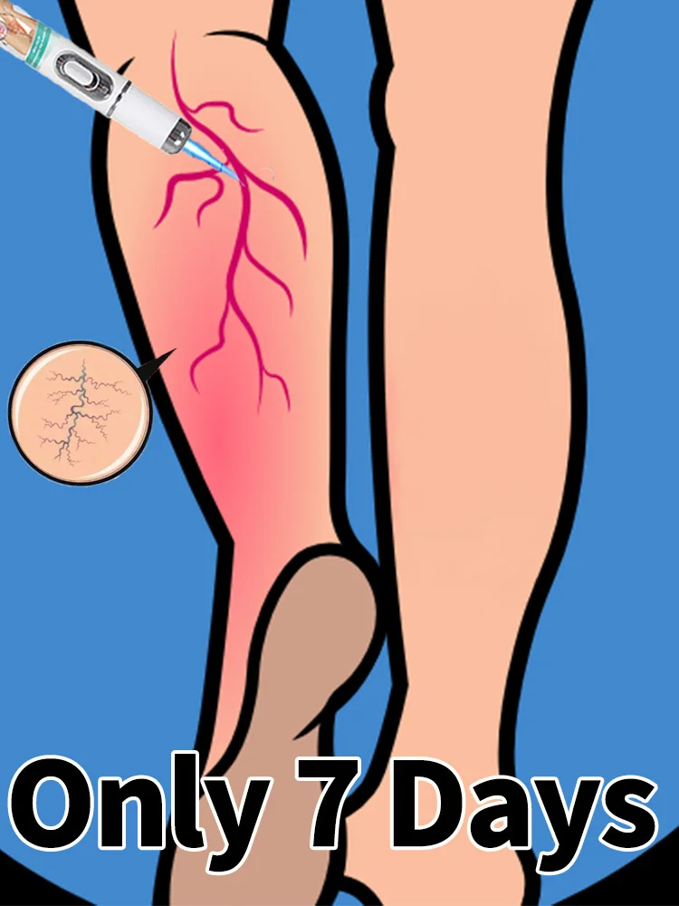 

Help you not have leg problems