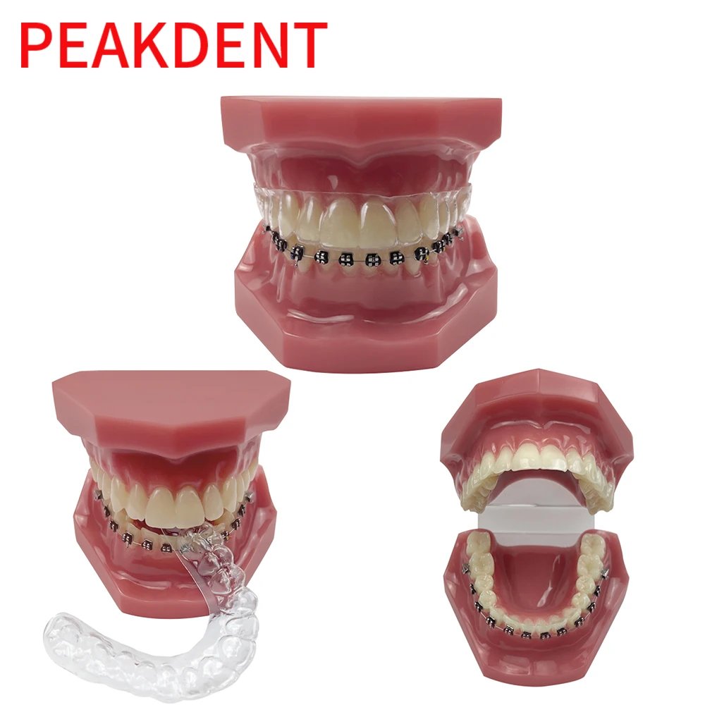 Invisible Braces Half Metal Bracket Retainer Dental Orthodontic Tooth Model  Correction Demonstration Dental Model