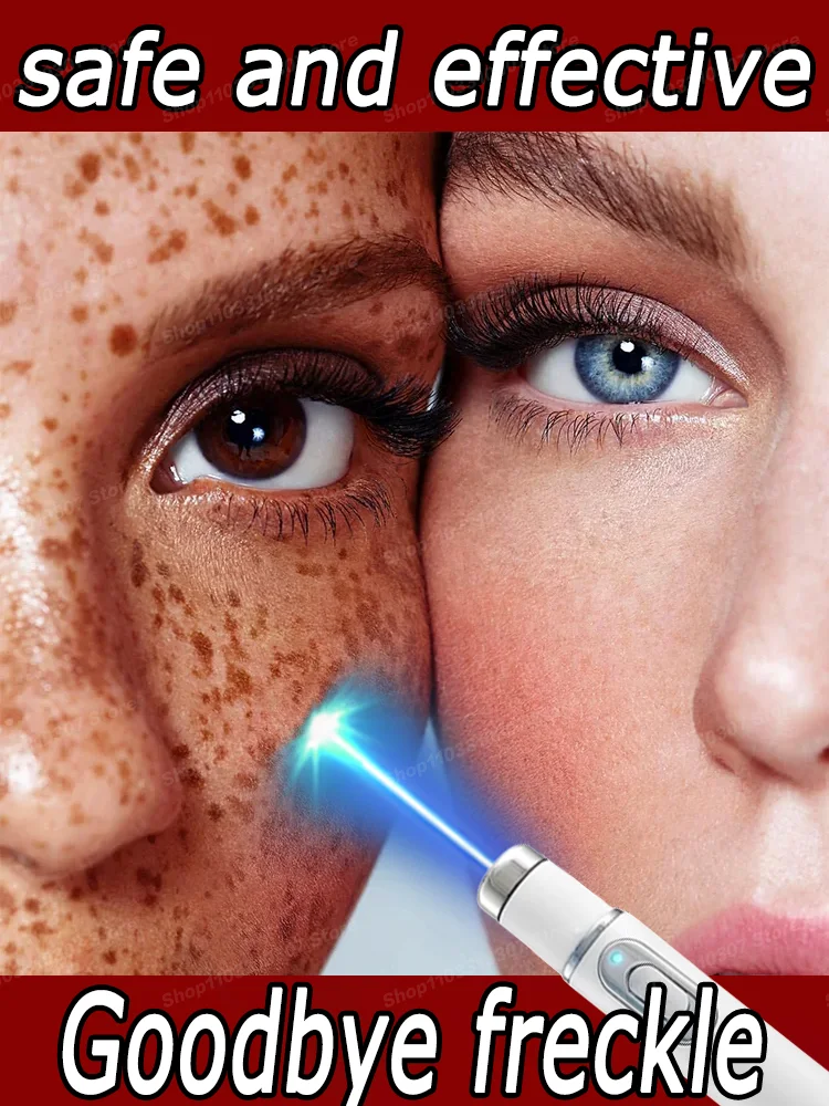 

Blu-ray pen Whitening Facial Spots