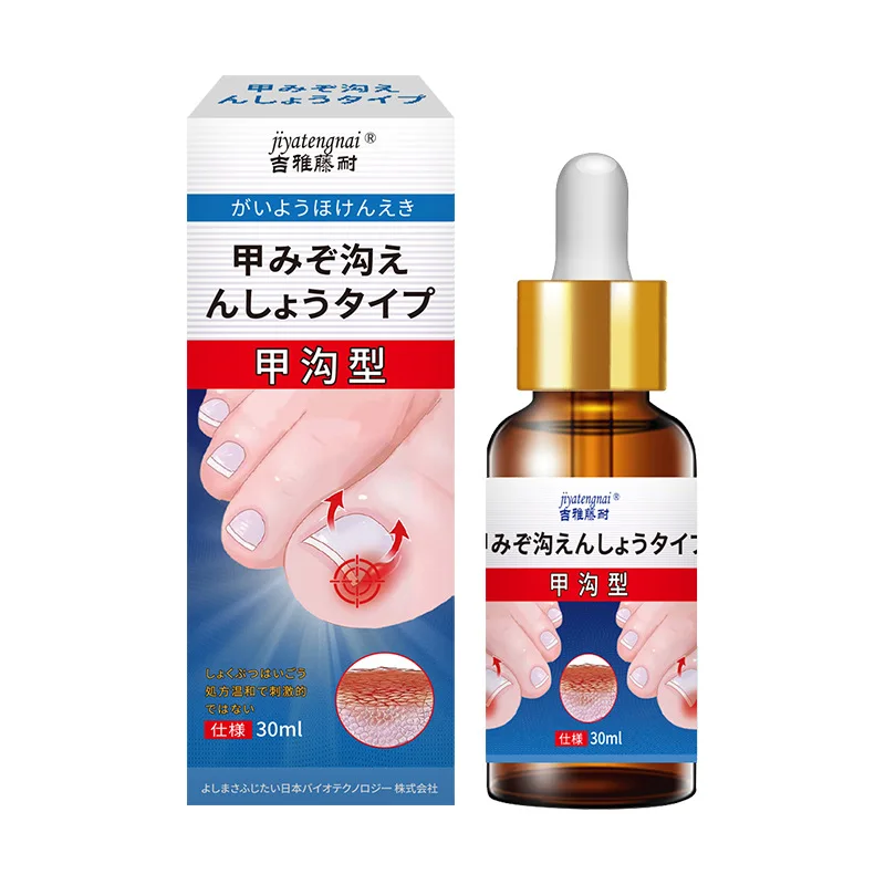 Jiyatengnai نوع الأخدود للأظافر محلول الرعاية الصحية الخارجية يهدئ أظافر القدم الغامضة والانتفاخ والازعاج حل مسحة الرعاية الخارجية