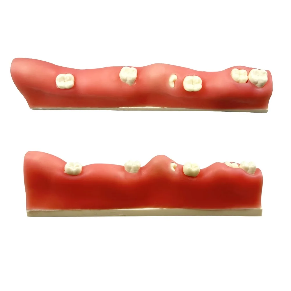 

Dental Impacted Tooth Extraction Practice Model Resin Materials Wisdom Tooth Teaching Study Model Dentistry Demonstration Tools