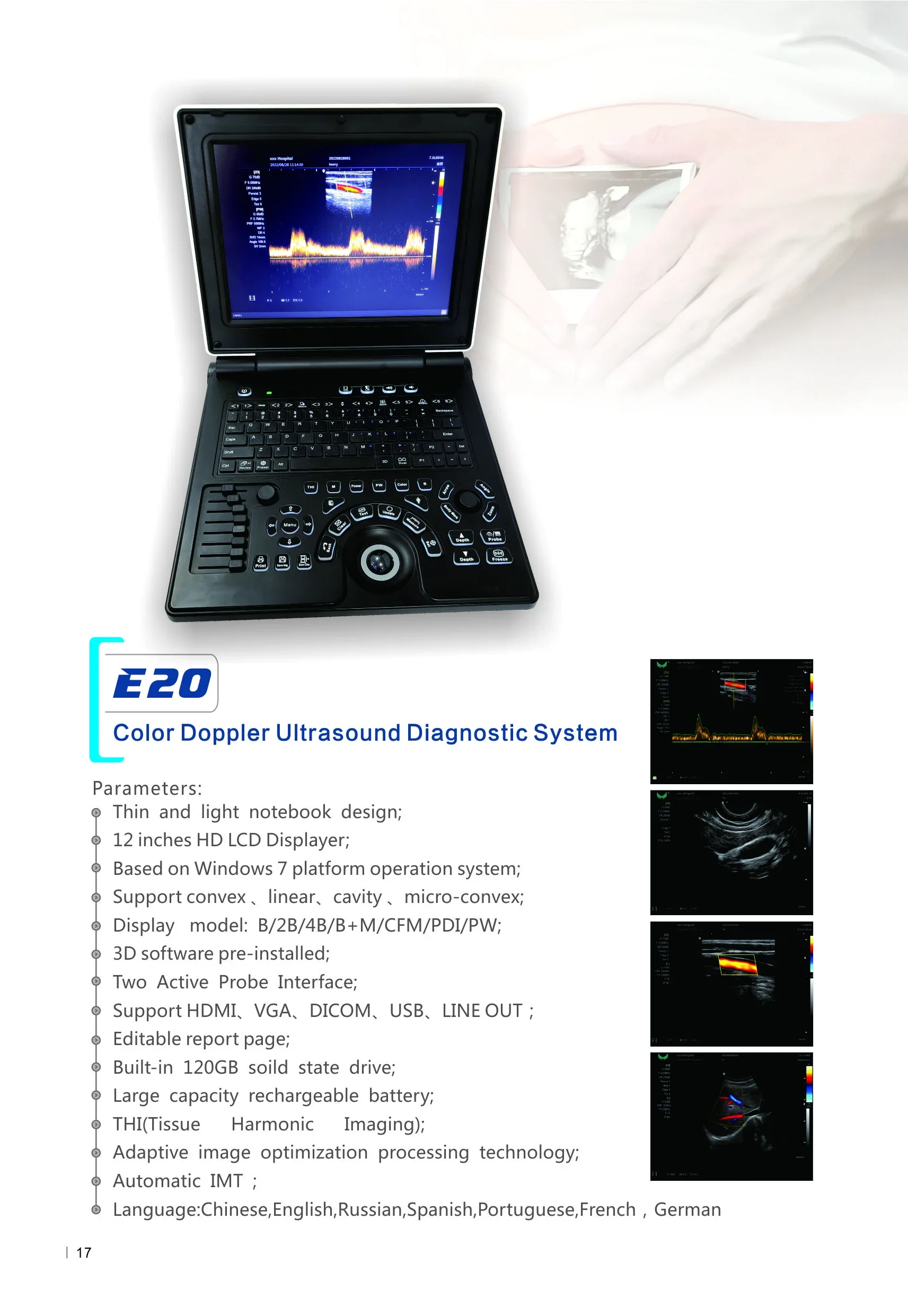 12 Inch Advanced 3D Color Doppler Medical Portable Laptop Notebook Pregnancy Ultrasound Scanner Machine