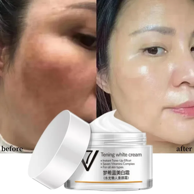 Lady Face V7 Tening White Cream  For Dark Skin Spots Scars Snow White Cream Day Night Face Cream For Skin Whitening Korean Skin