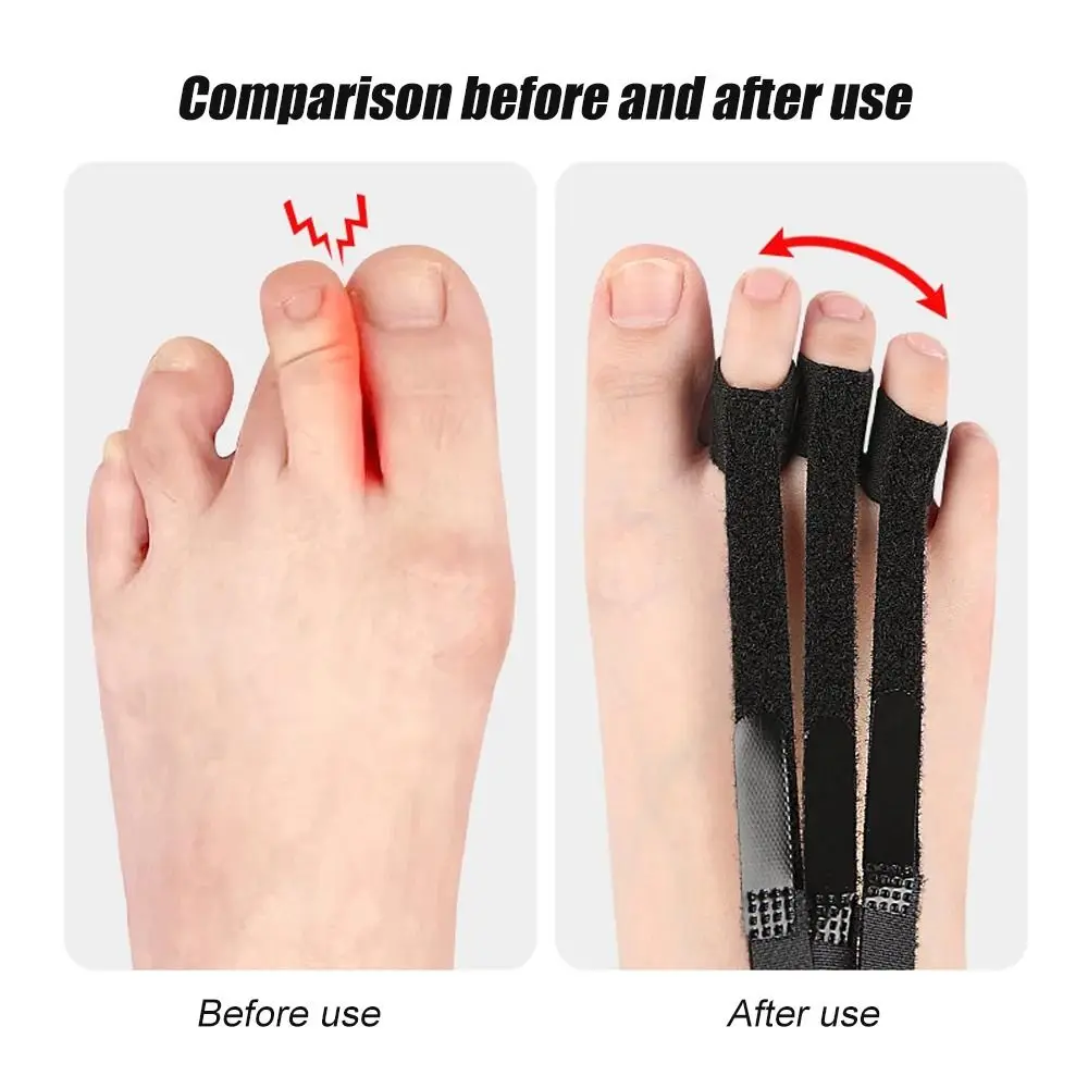 

Adjustable Toe Corrector Orthotics Metal Buckle Curled Toe Toe Valgus Corrector Fix&Adjust Breathable Toe Splint