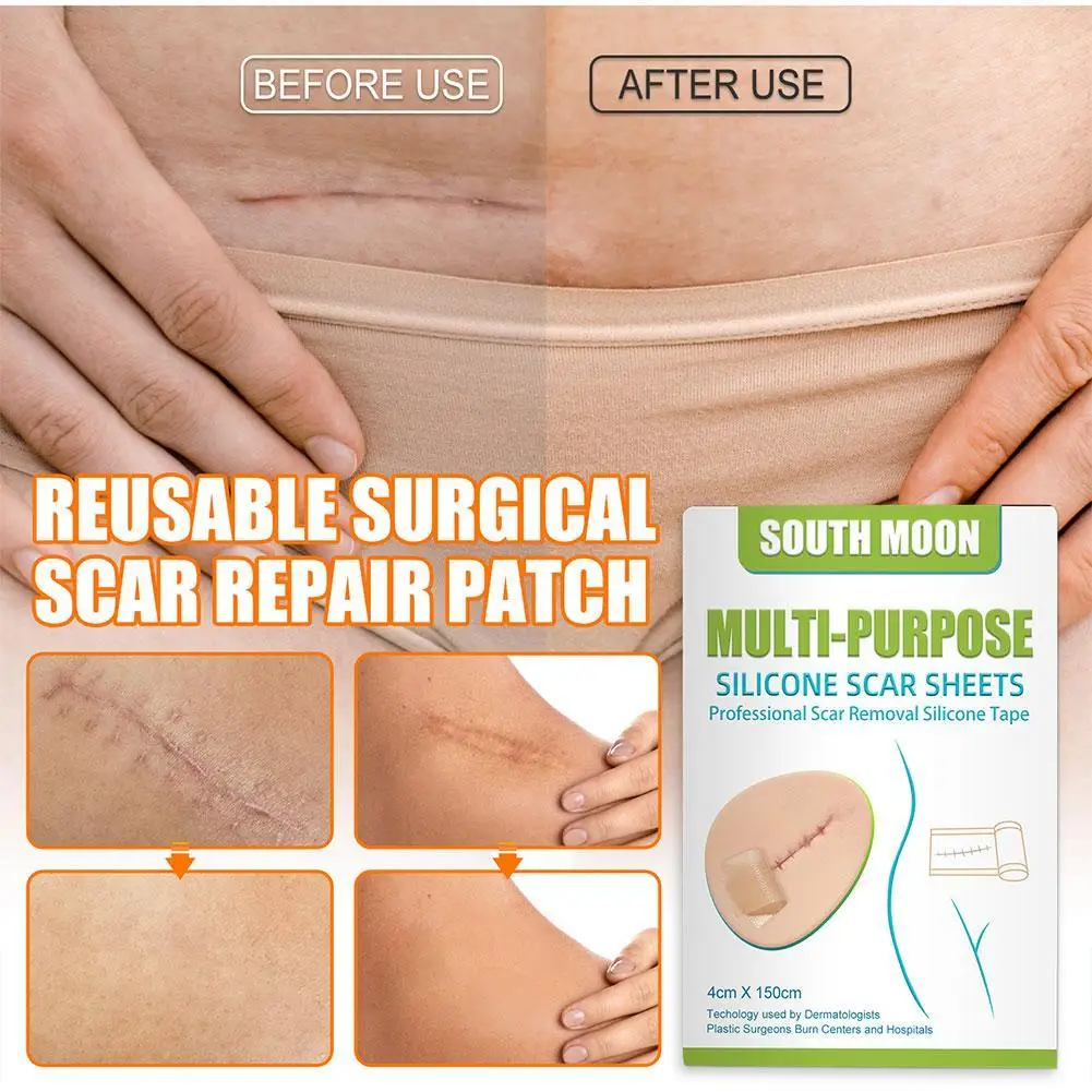 Silicone Surgical Scar Removal Patch Remove Trauma Burn Sheet Skin Repair Scar Removal Therapy Patch For Acne Scar Treatment