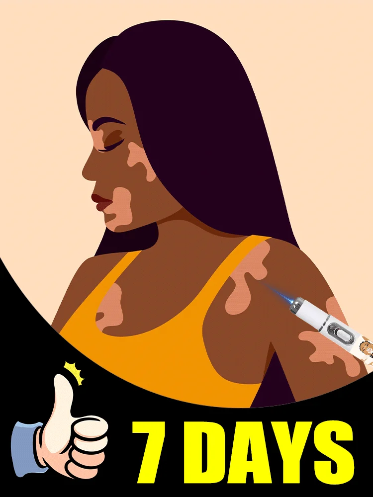 

In 7 Days，Generation-2 Laser Says Goodbye To Vitiligo
