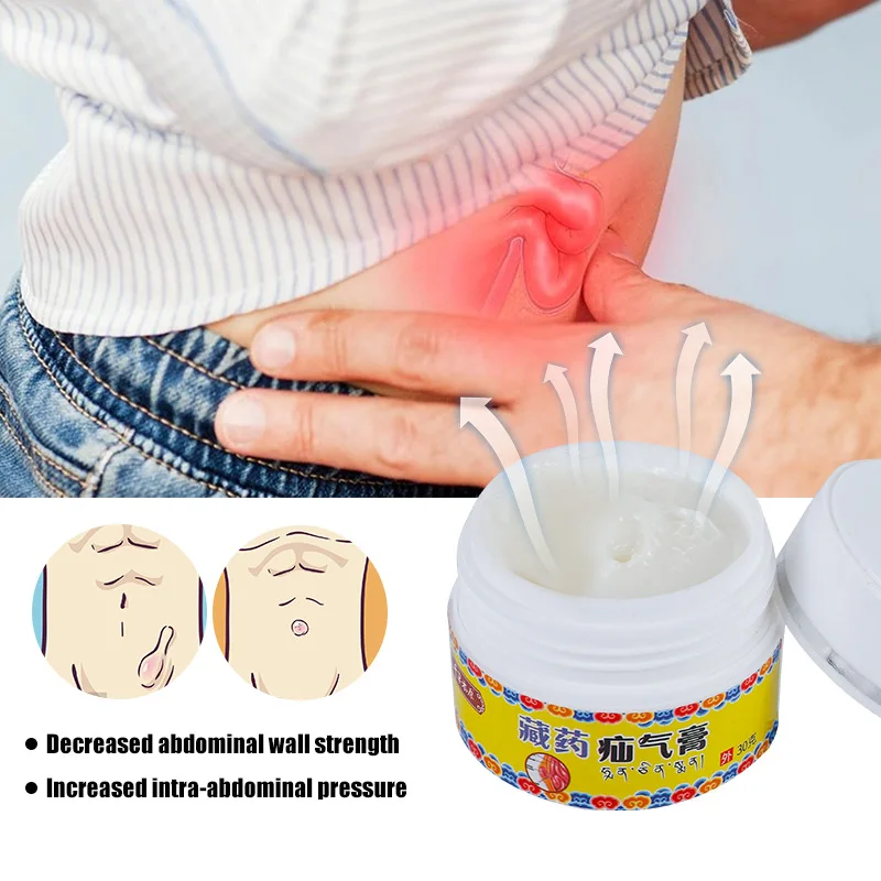 30g Hernia Treatment Cream Umbilical Pain Herbal Ointment Hiatal Hernia Inguinal Medical Plaster Belly Colic Oil Health Care