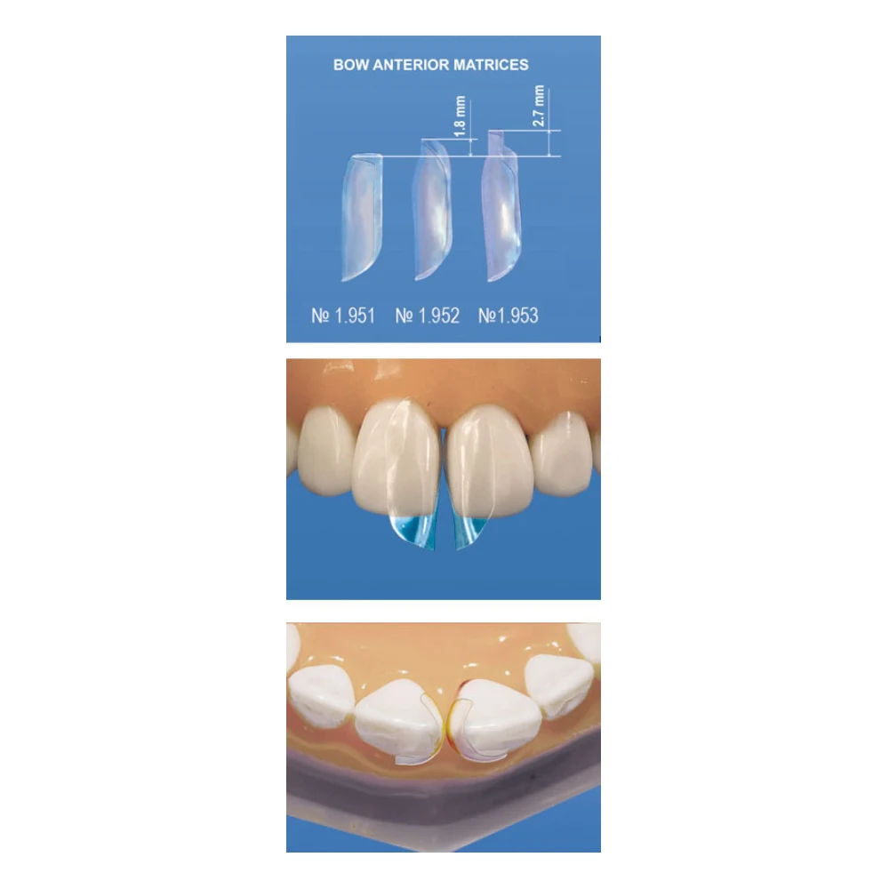 Dental Bow Anterior Matrices Plastic Proximal Strips 0mm 1.8mm 2.7mm